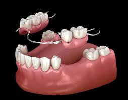 Dentures Image 1